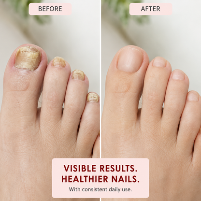Willowrise™ Multi-Purpose Nail Repair